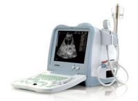 Full Digital Vet Ultrasound Scanner (KX2600, 11 Edition)