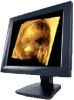 3D ultrasound video capture workstation software