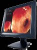Endoscope/Otoscope/Colposcope/etc. Image Report System Software