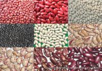 Light Speckled Kidney Beans