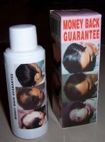 Hair Loss Treatment - Herbal Hair Lotion