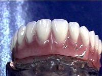 Dental denture materials high class