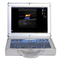 Hyperion  Ultrasound with dual touch-screens and wireless capabilities