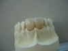 https://jp.tradekey.com/product_view/All-Ceramic-Restoration-Dental-Lab-Products-200955.html