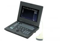 Laptop digital ultrasound scanner with CE ISO