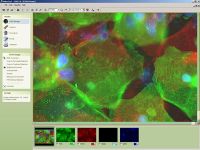 Image analysis software VideoTesT for FISH-analysis