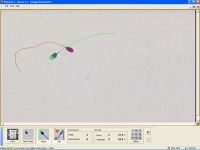 Image analysis software VideoTesT for sperm analysis