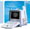 DIGITAL Ultrasound Scanner BW8T with extensive software