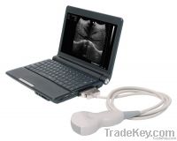 ultrasound scanner