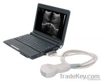 laptop ultrasound scanner