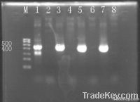 Recombinant pfu DNA polymerase