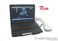 3000 Laptop Full Digital Ultrasound