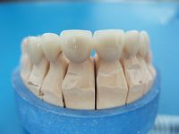 Dental Zirconium  All-Ceramic Crown