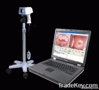 Digital Colposcope Imaging system