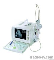 Digital Ultrasound Machines