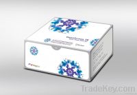 GenoScreen TB Real Time PCR Test Kit