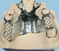 cast partial denture