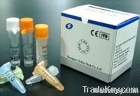 Hepatitis Virus Real Time PCR  Kit