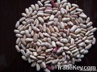 LSKB PSKB RKM etc Kidney Beans