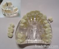 Dental Implant/Patient Education Models