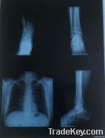 Laser medical  X ray film