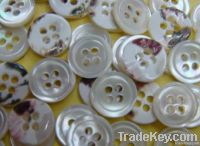 nature shell button, trocas shell button, mop shell button, black shell