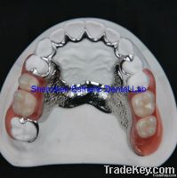 Dental Acrylic Denture