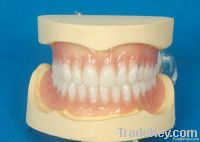 Dental acrylic removable partial denture