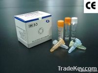 HCV Real Time RT-PCR Kit