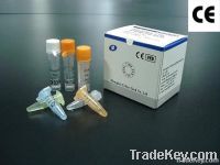 EBV Real Time PCR Kit