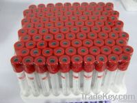 Serum Blood Collection Tube with Clot Activator