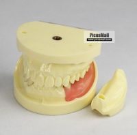 BAISTRA Dental Teach Implant Practice Model ZYR-2002