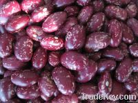 Purple Speckled Kidney Beans