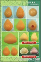 prosthesis breast and silicone breast enhancer