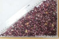 Purple Speckled Kidney Bean