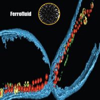 Magnetosome bacteria
