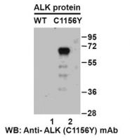 Anti-ALK (C1156Y) Mouse Monoclonal Antibody