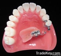 dental Precision Attachments Restoration for Teeth