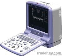 Portable Color Doppler Ultrasound Scanner