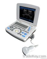 SS-10 Laptop PC Basic Ultrasound Scanner(3D image optional)