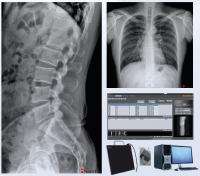 DR x-ray upgrade package