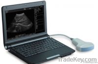 Portable Ultrasound Scanner (B Mode)
