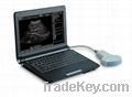 Portable/laptop ultrasound scanner(SW-1200A)