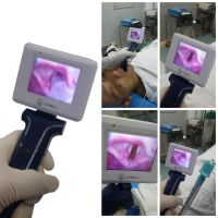 Besdata Reusable Anesthesia Difficult Airway Intubation Video Laryngoscope with CE ISO 13485