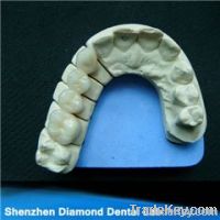 Dental Zirconia crowns and bridges
