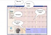 3 lead ECG
