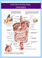 3D Medical Chart--Gastro-intestinal Disease
