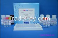 Betamethasone test kit(Urine)