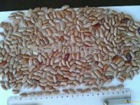 Light Speckled Kidney Bean (LSKB)