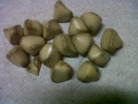 Human Gallstones for sale